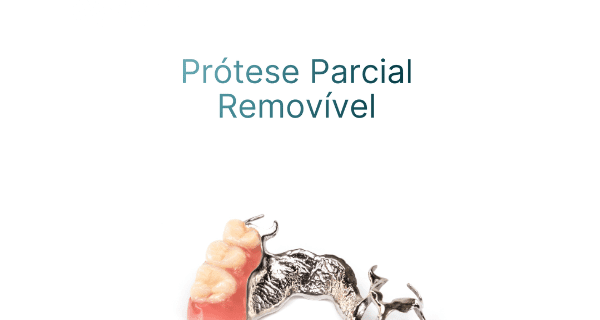 Prótese Parcial Removivel