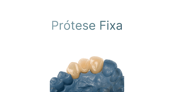 Prótese Fixa