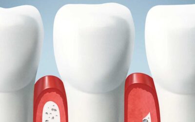 The Periodontal Guide: What it is, Anatomy, and Function